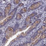 TRPM7 Antibody in Immunohistochemistry (Paraffin) (IHC (P))
