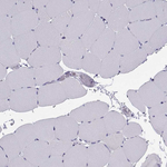 TRPM7 Antibody in Immunohistochemistry (Paraffin) (IHC (P))