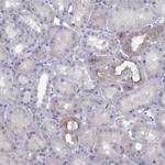 TRPM7 Antibody in Immunohistochemistry (Paraffin) (IHC (P))