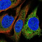 PTGIS Polyclonal Antibody