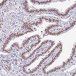 RAD50 Antibody in Immunohistochemistry (Paraffin) (IHC (P))
