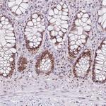 RAD50 Antibody in Immunohistochemistry (Paraffin) (IHC (P))