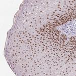 RAD50 Antibody in Immunohistochemistry (Paraffin) (IHC (P))