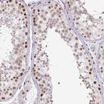 RAD50 Antibody in Immunohistochemistry (Paraffin) (IHC (P))