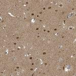PSMB7 Antibody in Immunohistochemistry (Paraffin) (IHC (P))