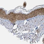 PSMB7 Antibody in Immunohistochemistry (Paraffin) (IHC (P))