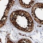PSMB7 Antibody in Immunohistochemistry (Paraffin) (IHC (P))