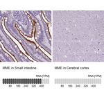 CD10 Antibody in Immunohistochemistry (Paraffin) (IHC (P))