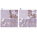CD10 Polyclonal Antibody