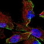 HPS3 Polyclonal Antibody