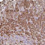 JMJD4 Antibody in Immunohistochemistry (Paraffin) (IHC (P))