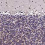 ZIC3 Polyclonal Antibody