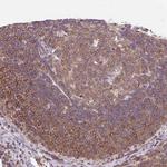 CARD11 Polyclonal Antibody