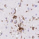 HLA-DRA Antibody in Immunohistochemistry (Paraffin) (IHC (P))