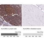 HLA-DRA Antibody in Immunohistochemistry (Paraffin) (IHC (P))