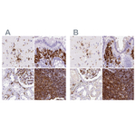 HLA-DRA Polyclonal Antibody