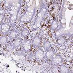 HLA-DRA Antibody in Immunohistochemistry (Paraffin) (IHC (P))
