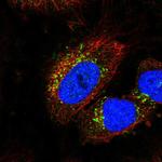 STK11IP Polyclonal Antibody