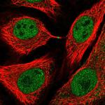 USP3 Polyclonal Antibody