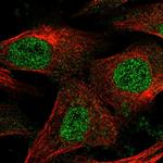 EPM2A Antibody in Immunocytochemistry (ICC/IF)