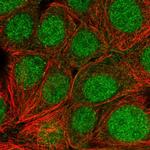 SKP1 Polyclonal Antibody