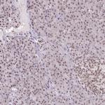 ORC3 Antibody in Immunohistochemistry (Paraffin) (IHC (P))