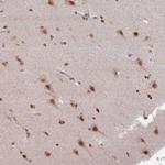 LHX5 Polyclonal Antibody