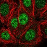 PSKH1 Polyclonal Antibody