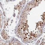 PSKH1 Antibody in Immunohistochemistry (Paraffin) (IHC (P))
