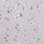 GABRG3 Polyclonal Antibody