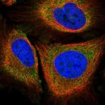 PLA2G4A Polyclonal Antibody