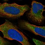 PKC epsilon Polyclonal Antibody