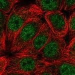 C1orf51 Polyclonal Antibody