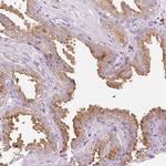 EVER2 Polyclonal Antibody