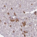 Thrombin Antibody in Immunohistochemistry (Paraffin) (IHC (P))