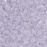 Thrombin Antibody in Immunohistochemistry (Paraffin) (IHC (P))