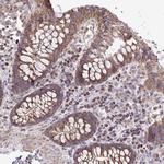 ATP13A2 Polyclonal Antibody