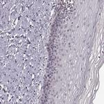 ASIC3 Polyclonal Antibody