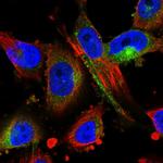 MARCKS Polyclonal Antibody