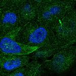 TRAIL Polyclonal Antibody