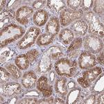 TRAIL Antibody in Immunohistochemistry (Paraffin) (IHC (P))