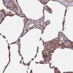 TRAIL Antibody in Immunohistochemistry (Paraffin) (IHC (P))