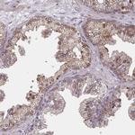 TRAIL Antibody in Immunohistochemistry (Paraffin) (IHC (P))