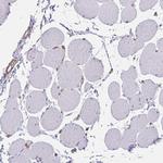 TRAIL Antibody in Immunohistochemistry (Paraffin) (IHC (P))