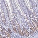 Carbonic Anhydrase IX Antibody in Immunohistochemistry (Paraffin) (IHC (P))