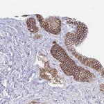 Carbonic Anhydrase IX Antibody in Immunohistochemistry (Paraffin) (IHC (P))