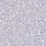 Carbonic Anhydrase IX Antibody in Immunohistochemistry (Paraffin) (IHC (P))