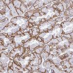 Carbonic Anhydrase IX Antibody in Immunohistochemistry (Paraffin) (IHC (P))