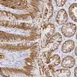 SMURF1 Polyclonal Antibody