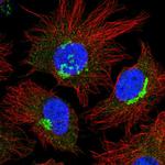 FKBP9 Polyclonal Antibody